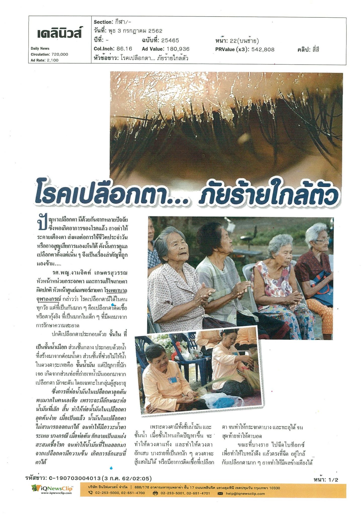 บทความ เรื่องโรคเปลือกตา…ภัยร้ายใกล้ตัว