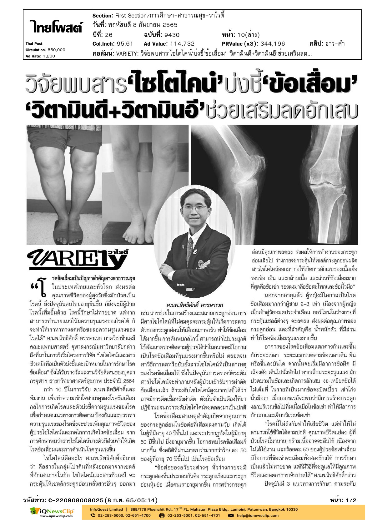บทความ : วิจัยพบสาร “ไซโตไคน์” บ่งชี้ “ข้อเสื่อม”  “วิตามินดี+วิตามินอี” ช่วยเสริมลดอักเสบ