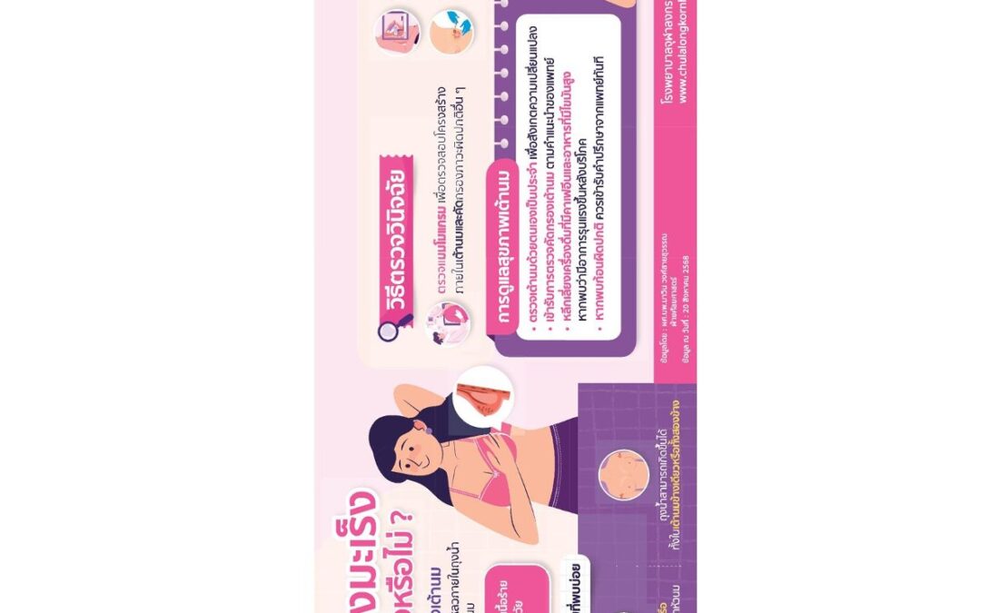 บทความเรื่อง : โรคถุงน้ำในเต้านม (Simple Breast Cyst) เสี่ยงมะเร็งจริงหรือไม่
